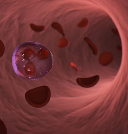 Queens Vascular Surgery Doctor